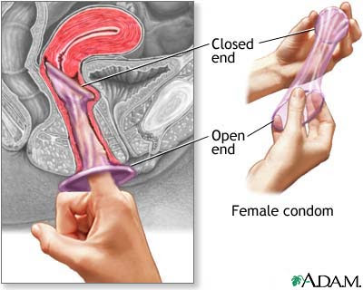 Female-Condoms