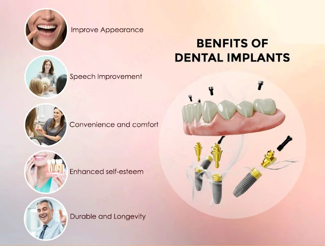 advantages of dental implants