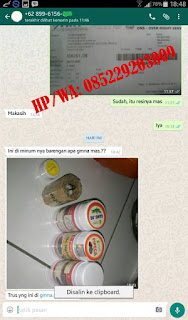 Bukti Real Asli Barang Sampai Obat Kutil Kelamin