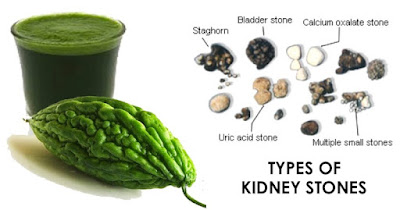 How To Drink Bittergourd Juice To Break Down Kidney Stones For Elimination