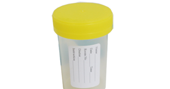 Jual Urine Container Pot Steril Botol Urine Air Kecing 