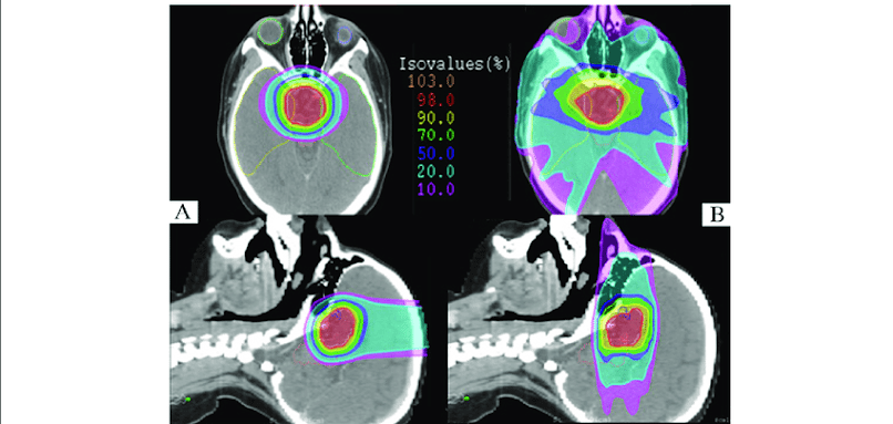 Intensity-Modulated Proton Therapy