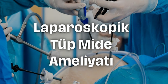 Laparoskopik Tüp Mide Ameliyatı