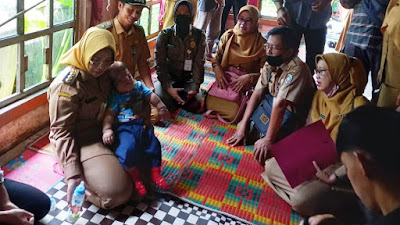 Pemda Mempawah Siap Bantu Biaya Pengobatan Qori Bayi Tanpa Tempurung Kepala