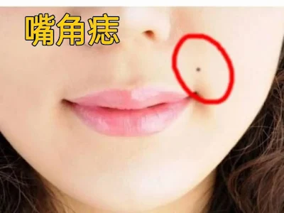 관상