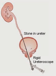 Ramayya Pramila Urology Hospital: November 2014