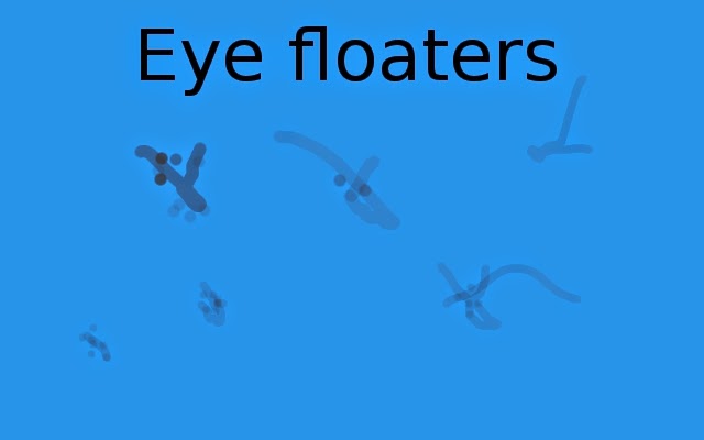Eye floaters are probably fungal infection