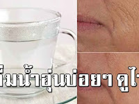 ดื่มน้ำอุ่นตามช่วงเวลา ดื่มให้ถูกวิธี ช่วยได้ในหลายเรื่อง