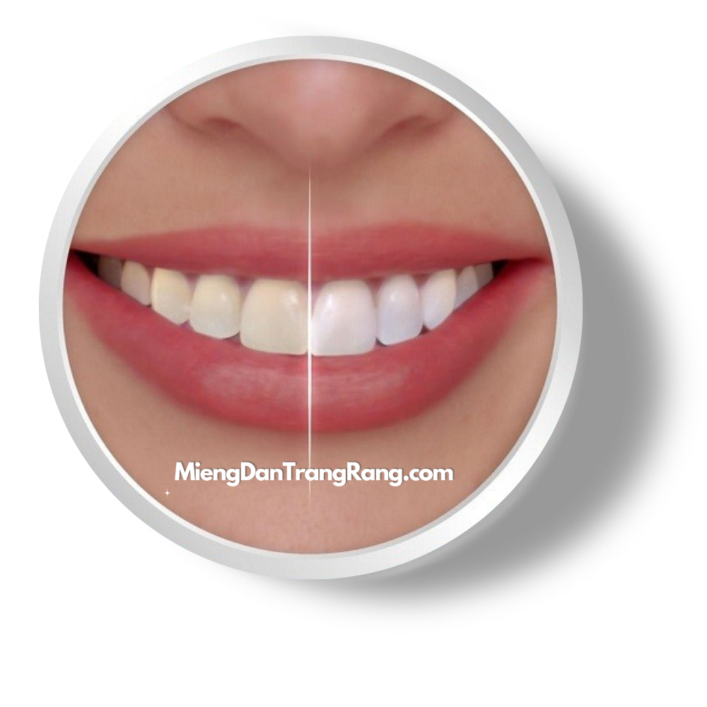 Miếng dán trắng răng Crest 3D Whitestrips