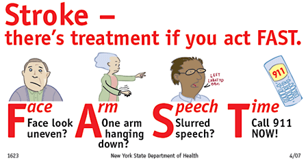 Stroke is a medical emergency.