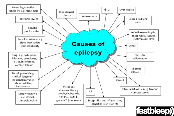 Pijat refleksi untuk sakit ayan (epilepsi)  Pijat Refleksi