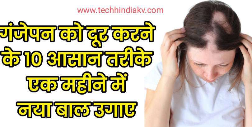 दबर नए बल उगन क लए जनए 1 मतर नचरल तरक बस 30 रपय म  regrow new hair  hair loss  YouTube