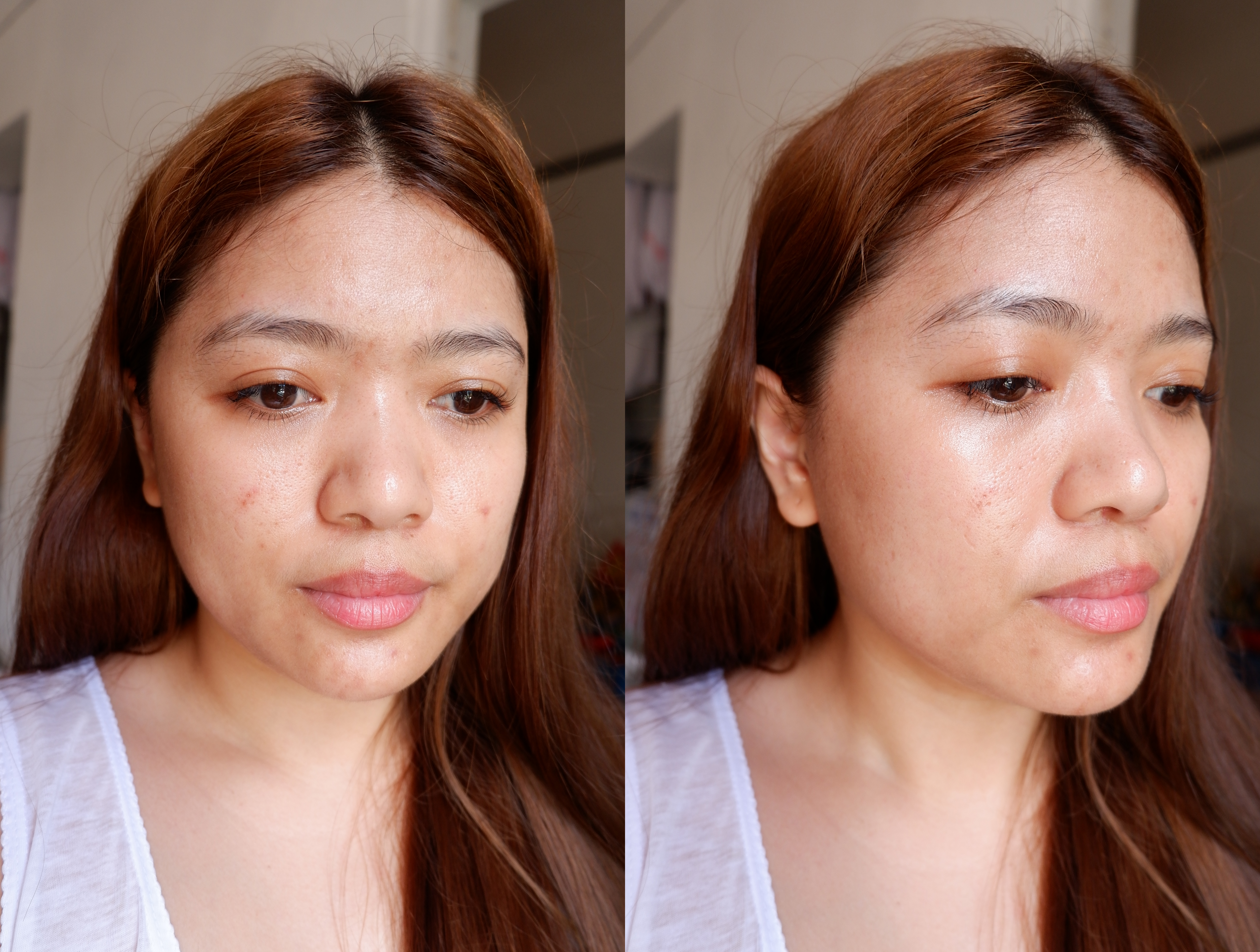 SKIN1004 HONEST REVIEW ON THEIR CENTELLA MADAGASCAR LINE