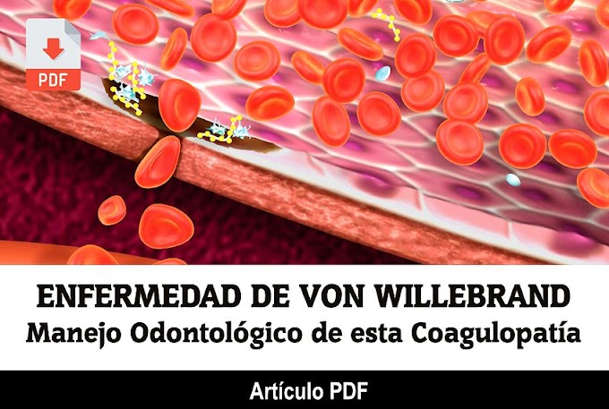 PDF: ENFERMEDAD de VON WILLEBRAND: Manejo Odontológico de esta Coagulopatía