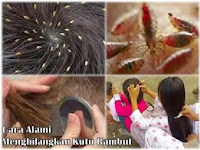 AJAIB.!! TAK TERDUGA TAPI NYATA BAWANG MERAH SELAIN TERBUKTI MENGUATKAN AKAR RAMBUT JUGA BISA MEMBASMI KUTU DI RAMBUT BESERTA TELUR-TELURNYA ,BEGINI CARA MEMBUAT RAMUANNYA