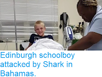 https://sciencythoughts.blogspot.com/2018/04/edinburgh-schoolboy-attacked-by-shark.html