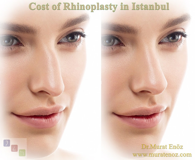 Rhinoplasty cost in Istanbul - Prices for rhinoplasty in Istanbul - Cost of rhinoplasty in istanbul, Turkey - Cost of nose job in istanbul - Nose aesthetics prices in istanbul - What does nose aesthetic prices vary? - Does nose aesthetic prices change according to nose? - Why is complicated nose job surgery fees higher? - Prices for rhinoplasty in the world