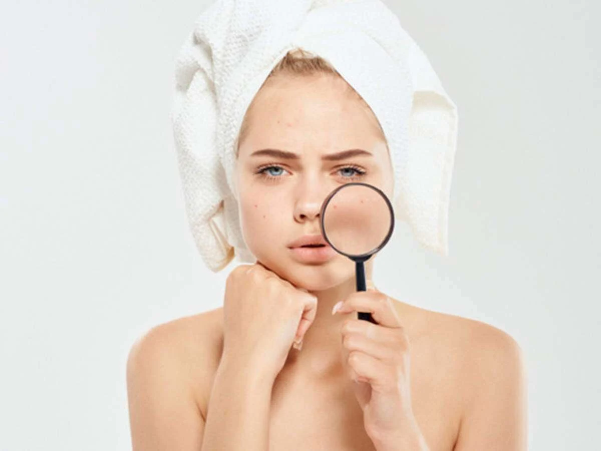 Banishing Blemishes: Tips for Reducing Dark Spots on Your Face