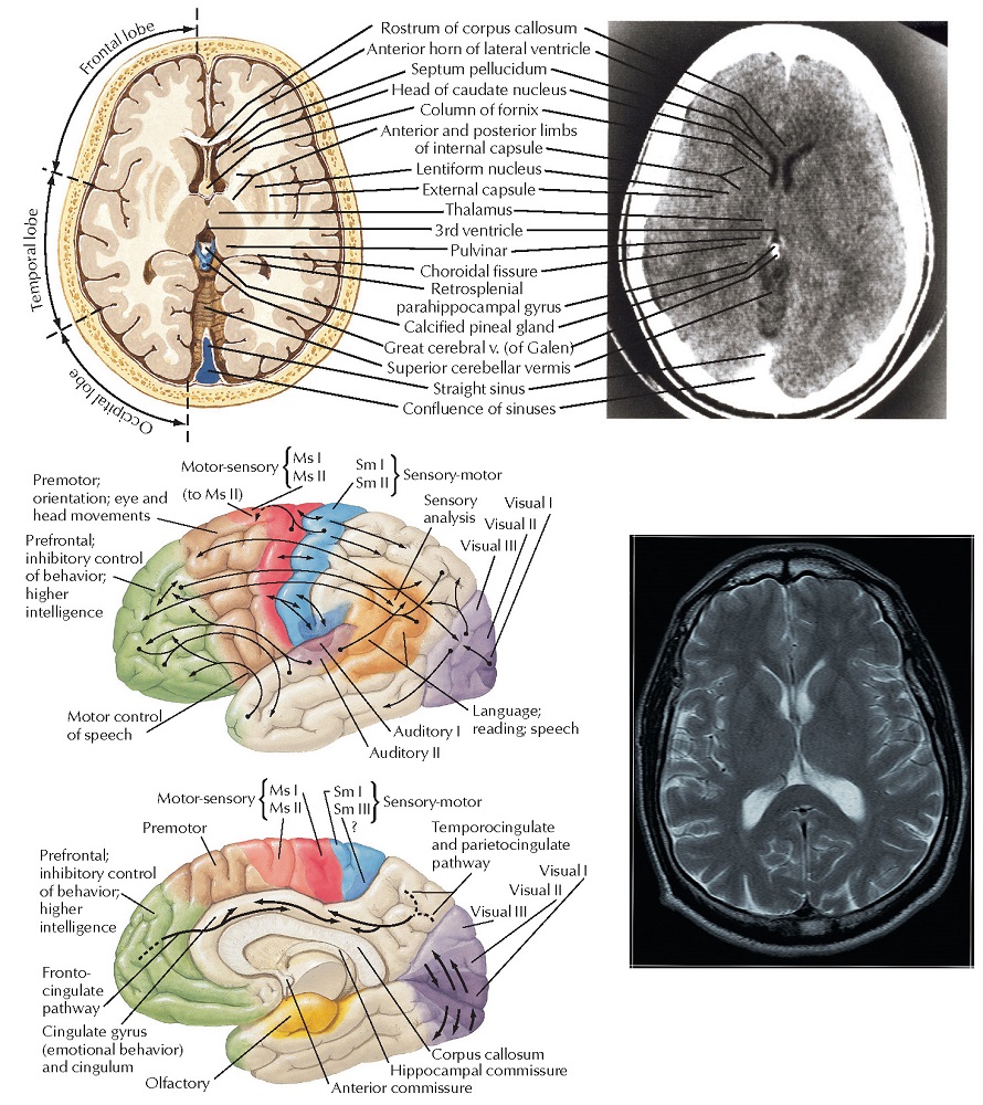 Functional Correlations and Visualization of Brain Structures