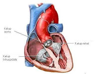 penyakit katup jantung, penyakit klep jantung, Blog Keperawatan