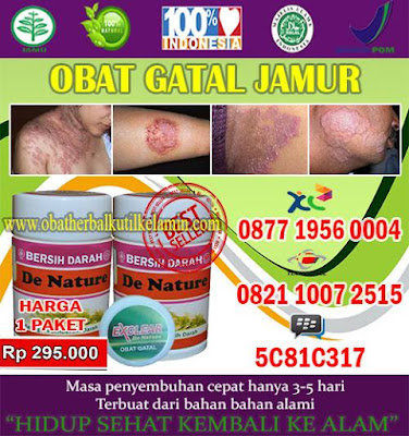 Obat Tradisional Gatal Di Selangkangan Pada Pria