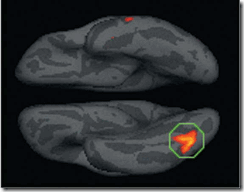 Visual area correlated with meditation experience. Statistical map depicting cortical thickness correlated with change in respiration rate.