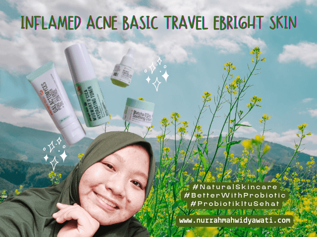 Review Inflamed Acne Basic Travel eBright Skin