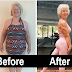 73-Year-Old Mom Loses Over 50 Pounds With The Help Of Her Daughter, Now Her Before And After Pics Go Viral 