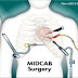 All Details in Open Heart Surgery