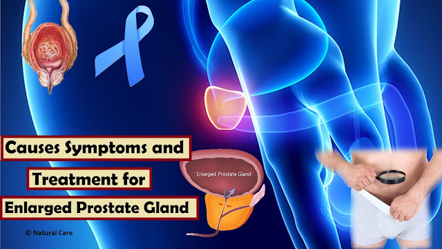 Causes Symptoms and Treatment for Enlarged Prostate Gland