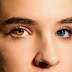 ¿Por qué algunas personas tienen los ojos de distinto color?