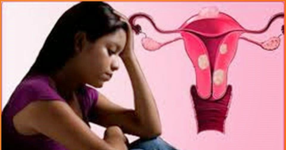 Apa itu Menorrhagia - Blogbabyshambles