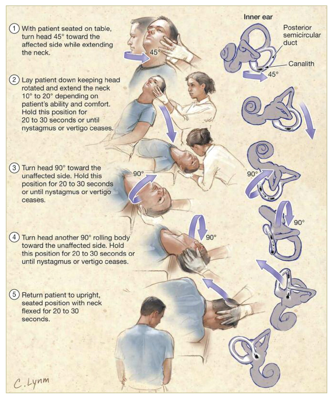 Fitnesspedia Vertigo Exercises Fitnesspedia Vertigo Exercises