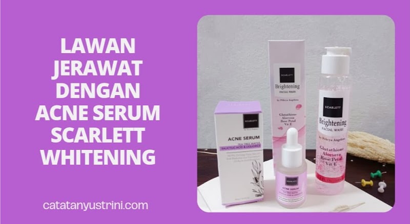 Lawan Jerawat dengan Acne Serum Scarlett Whitening