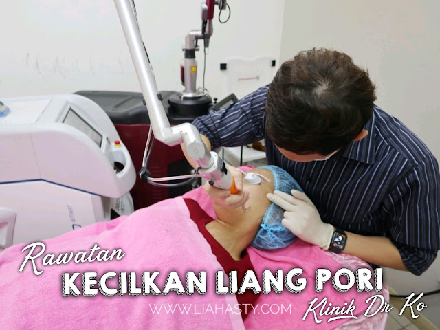 Rawatan Kecilkan Liang Pori di Klinik Pakar Kulit Dr. Ko Juru