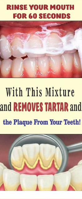 Rinse Your Mouth For 60 Seconds With This Mixture and Removes Tartar and the Plaque From Your Teeth!