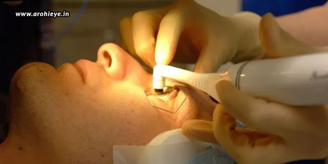 Best Cataract Surgery in Mumbai