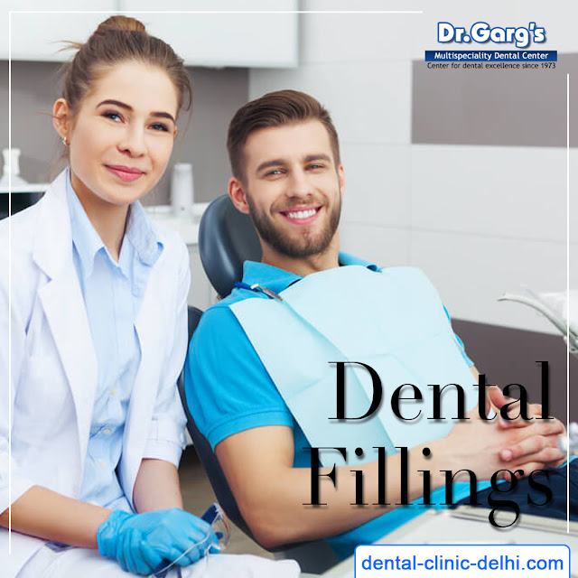 Dental Fillings in India