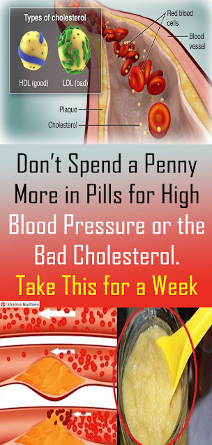 Don’t Spend a Penny More in Pills for High Blood Pressure or the Bad Cholesterol. Take This for a Week
