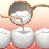 Địa chỉ trám răng uy tín ở tphcm