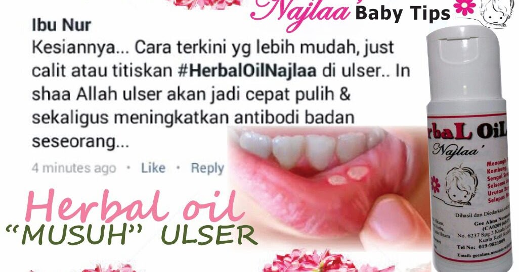Tinta mama: ulser? oh nooo