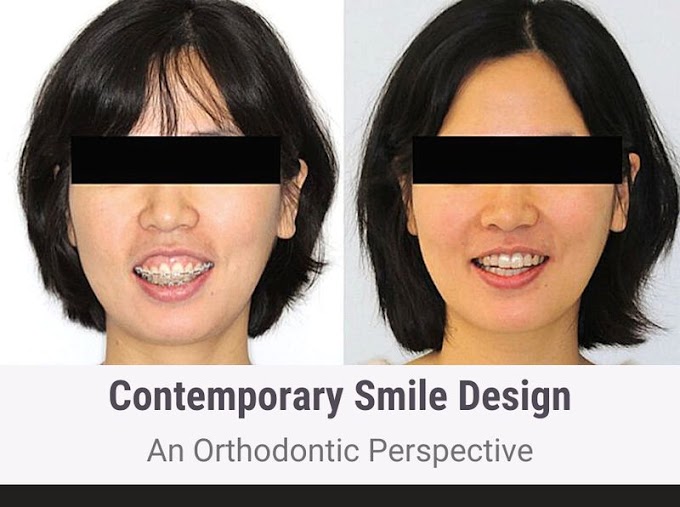 PDF: Contemporary Smile Design: An Orthodontic Perspective