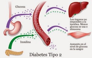 El Quinto Blog: La diabetes tipo 2 se puede revertir (curar)