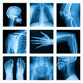 importance of X-rays 