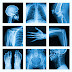 Importance of X-rays