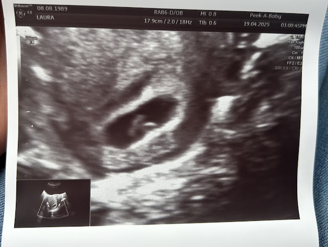 6 weeks pregnant - Rainbow Baby
