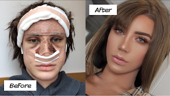 id Facial Feminization Surgery