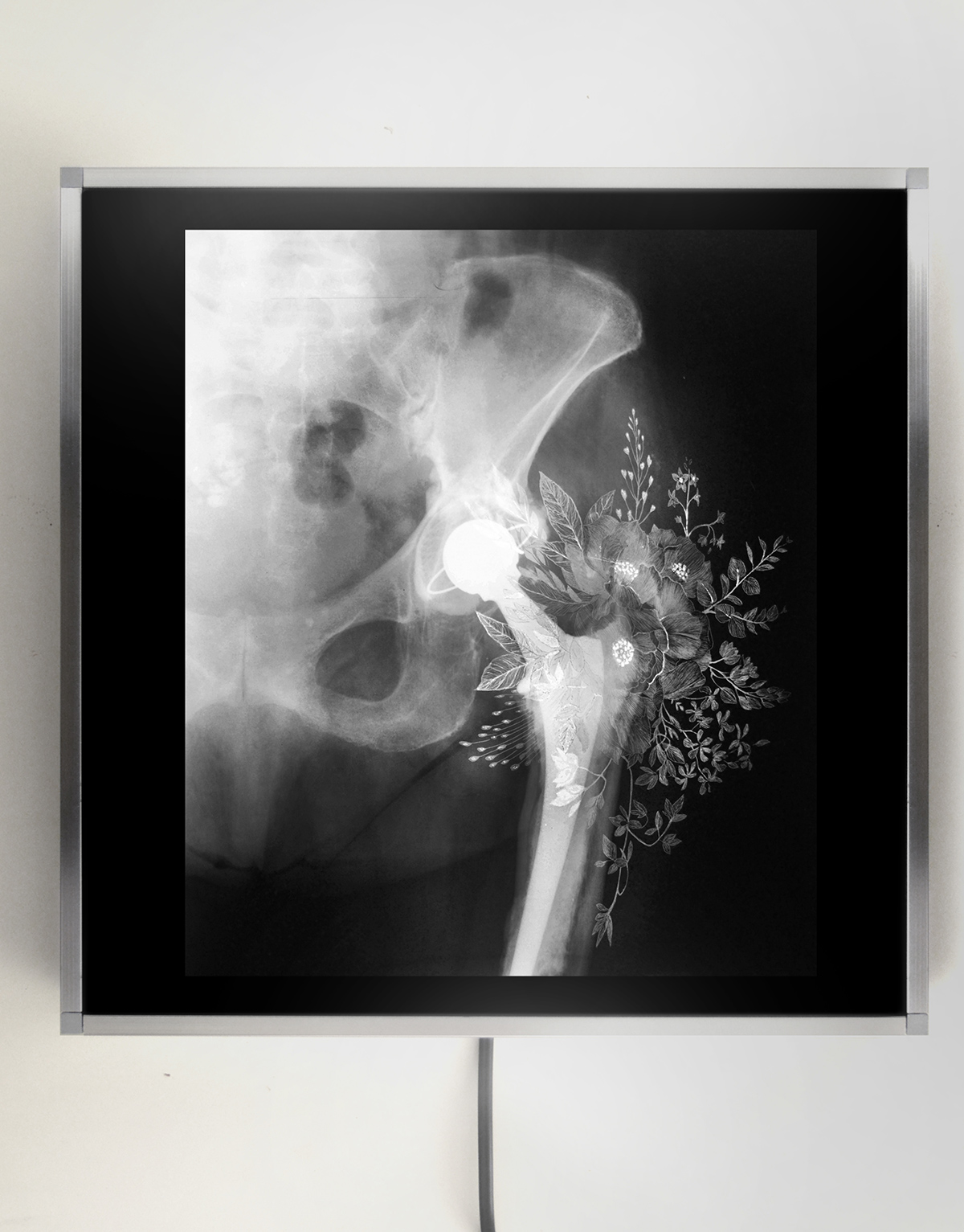 Nunzio Paci - Floral Prosthesis, Manually altered x-ray on LED lightbox