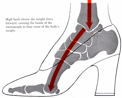https://blogger.googleusercontent.com/img/b/R29vZ2xl/AVvXsEiD3FdA5UmBPBFf8rmQ2qJr5hUXpNqQeoS41tTAeBg2MHgSr36hT1mw3dOhhJt2sBqt77RkSoWEP8wg03lAFwgZ7NY-khHkWBhVsoCez2dJOpAJVLCNxR_gVd_2_OXPQkj5XONqpowaVsU/s1600/High+Heels+Health+Risk+%232.gif