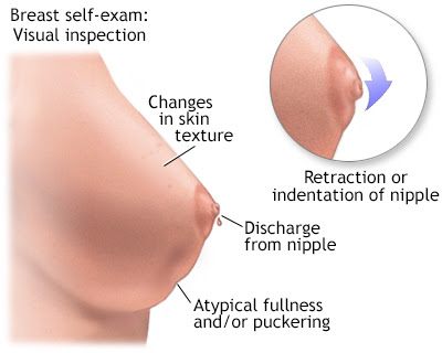 Breast changes in cancer